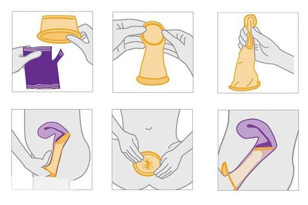 Các bước sử dụng bao cao su nữ Các bước sử dụng bao cao su nữ